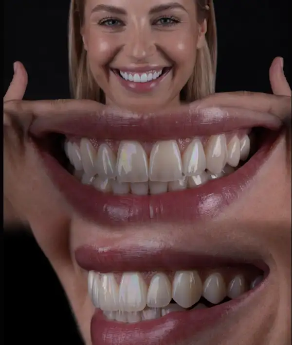 Zirkonyum Kaplama Tedavisi