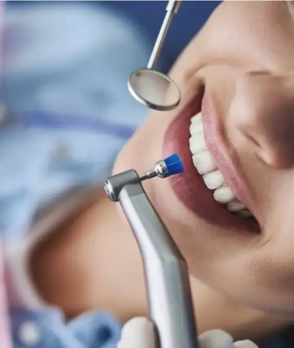 Diş Taşı Temizliği